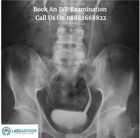 X Ray IVP Cost in India