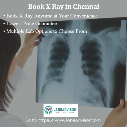 X Ray in Chennai